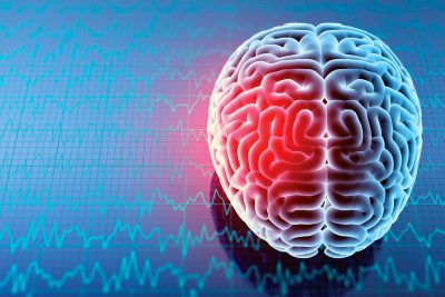 Repetitive head impacts and trauma